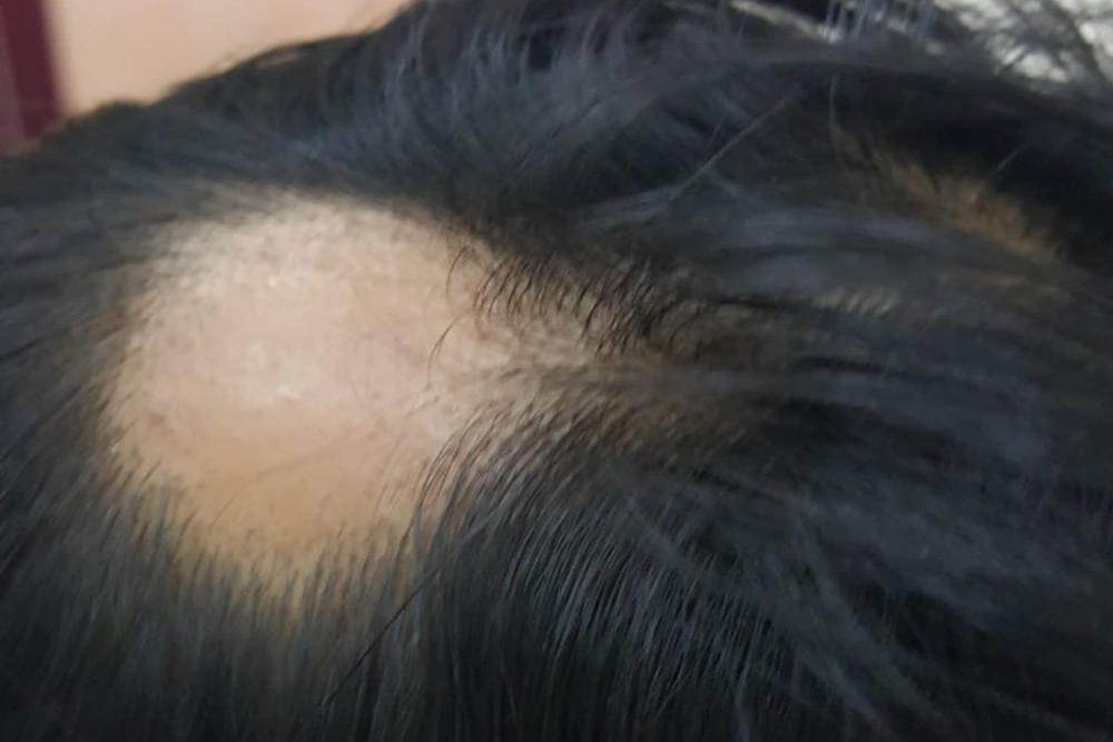 Patient 7 before