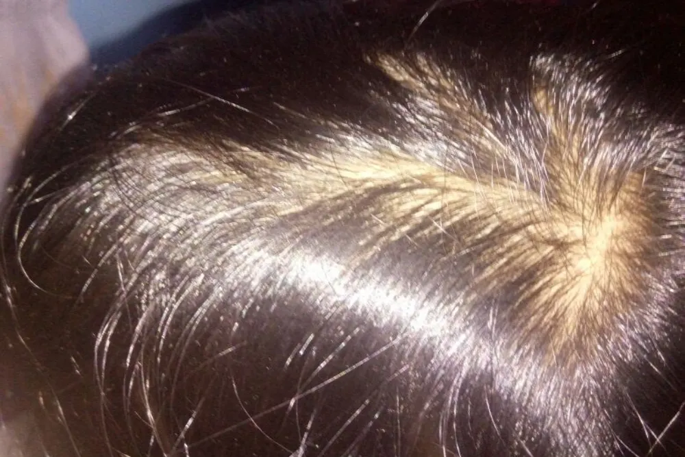 Patient 7 after