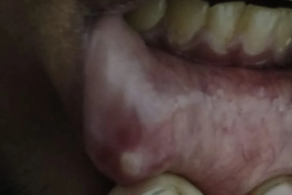 Dr Yogesh Sehgal Patients Before After